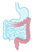  Inflammation colite ulcéreuse